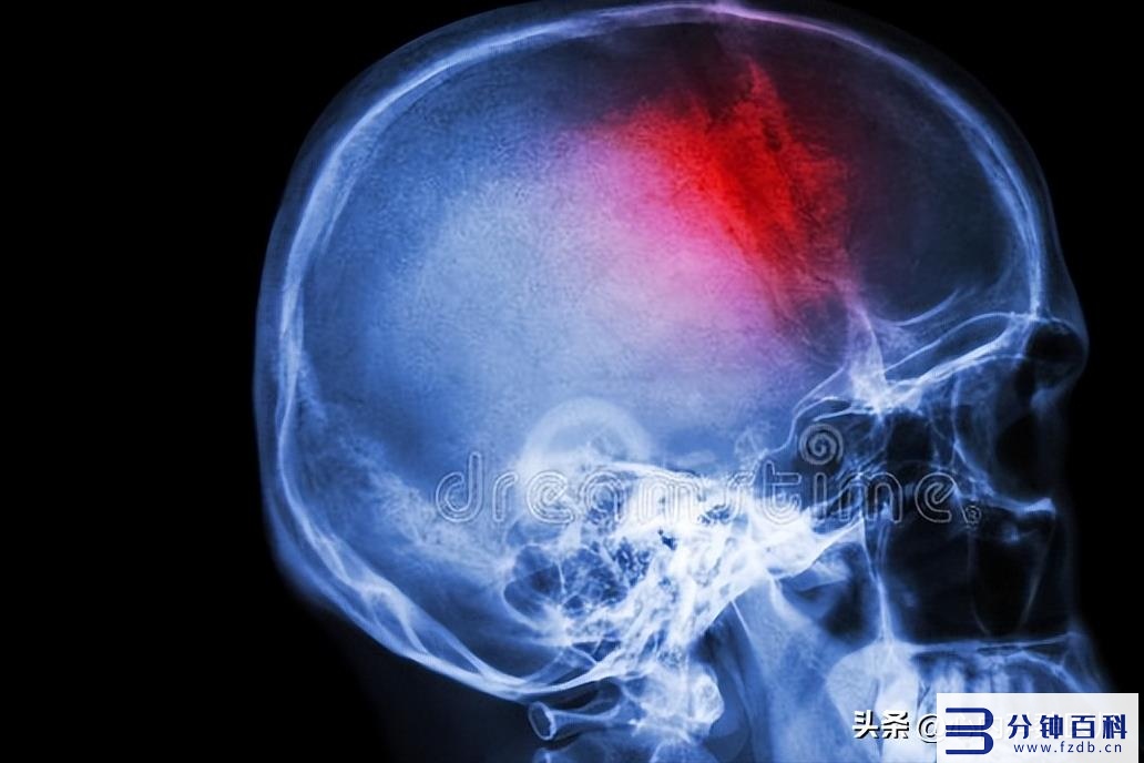 血液循环不好如何改善(小腿血液循环不好如何改善)插图9 血液循环不好如何改善(小腿血液循环不好如何改善)插图9