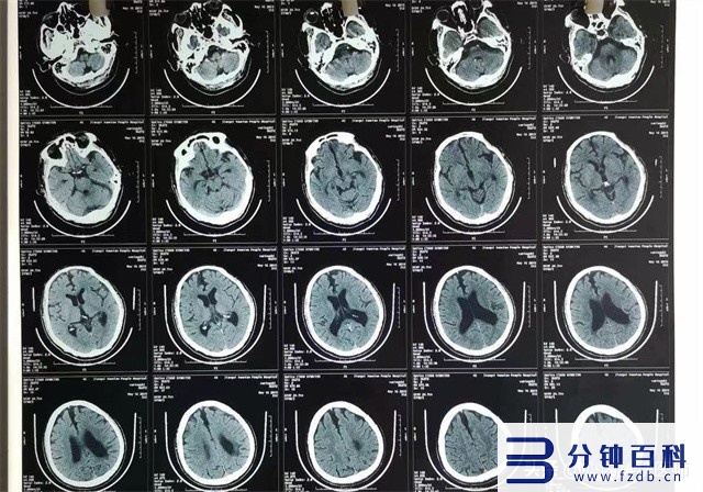 血液循环不好如何改善(小腿血液循环不好如何改善)插图1 血液循环不好如何改善(小腿血液循环不好如何改善)插图1