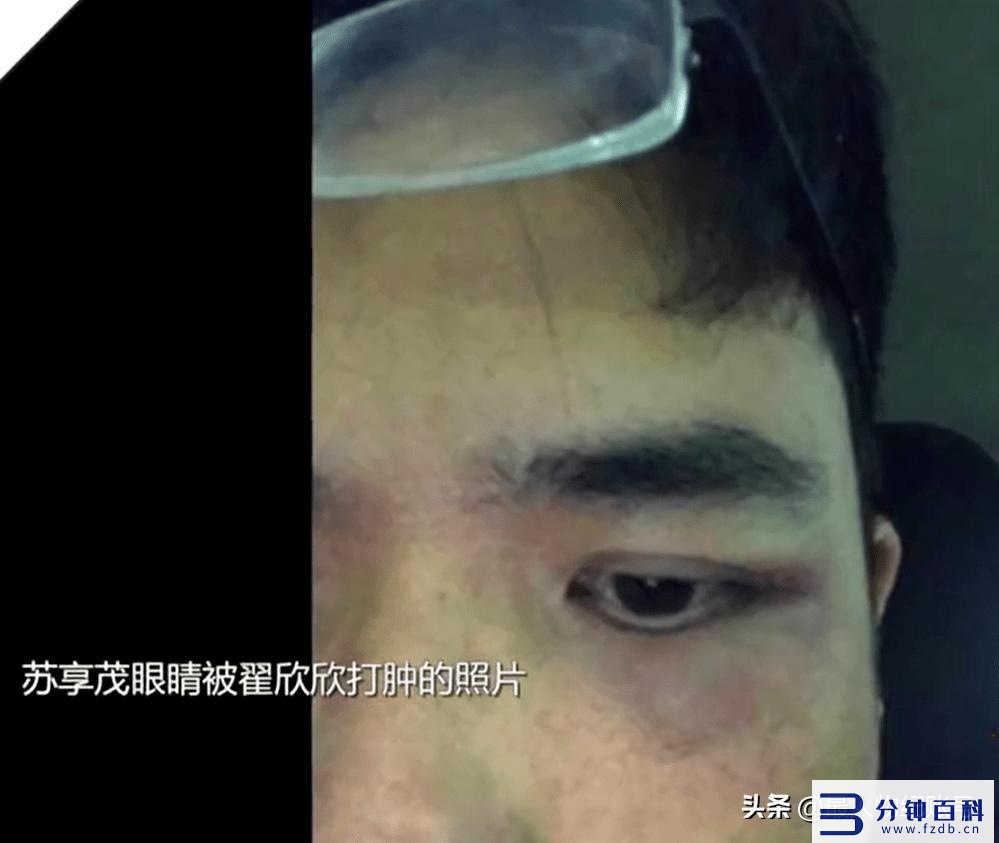 翟欣欣最后处理结果(翟欣欣最后处理结果2022)插图19 翟欣欣最后处理结果(翟欣欣最后处理结果2022)插图19
